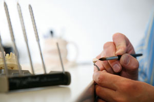 UK Veneers (Keramikschalen)